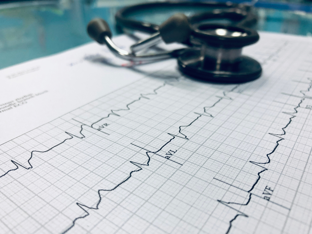 Sessão Clínica - Bradiarritmia